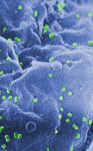 HIV på lymfocyt